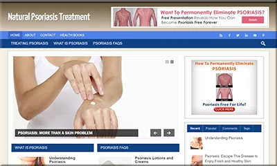 Ready Made Psoriasis Treatment Website with Awesome Design
