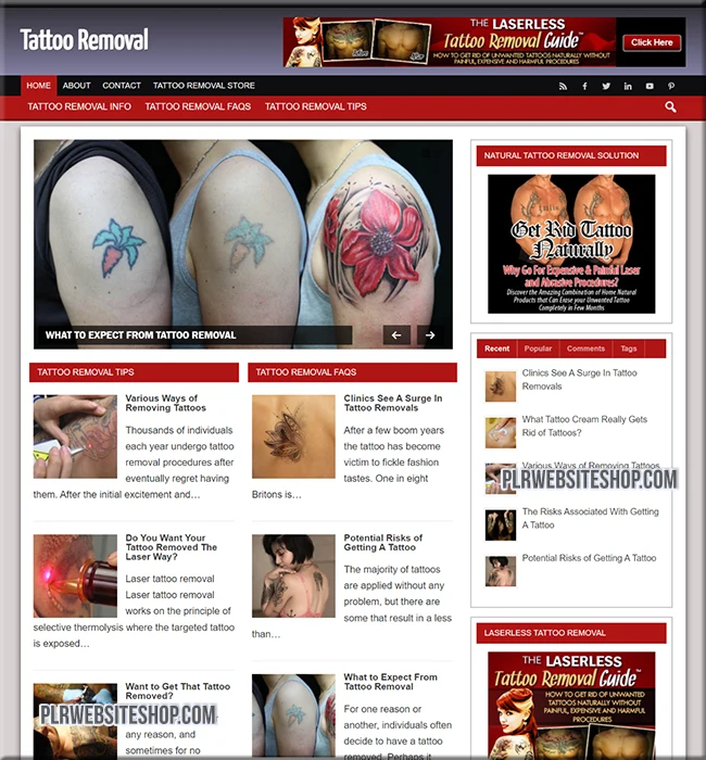 tattoo removal ready made website